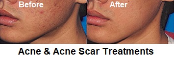 Skinsense Laser & Medical Aesthetics Specialists.  The only professional male and female skin, body and hair treatment speicialists for men and women in Port Vila, Vanuatu