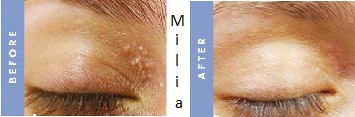 Skinsense Laser & Medical Aesthetics Specialists.  The only professional male and female skin, body and hair treatment speicialists for men and women in Port Vila, Vanuatu