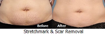 Skinsense Laser & Medical Aesthetics Specialists.  The only professional male and female skin, body and hair treatment speicialists for men and women in Port Vila, Vanuatu