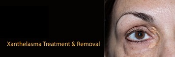 Skinsense Laser & Medical Aesthetics Specialists.  The only professional male and female skin, body and hair treatment speicialists for men and women in Port Vila, Vanuatu